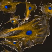 Dichromat simulation of daltonized color cells.