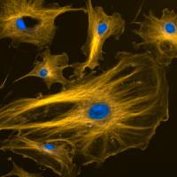 Deuteranope simulation of fluorescent cells